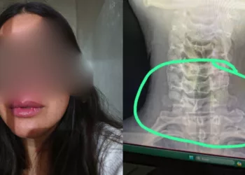 Doctora denuncia golpiza en alcoholímetro y desata ola de indignación contra policías de Santa Cruz Amilpas