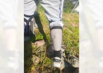 Alertan a corredores y patinadores por jauría en la carretera de San Mateo.