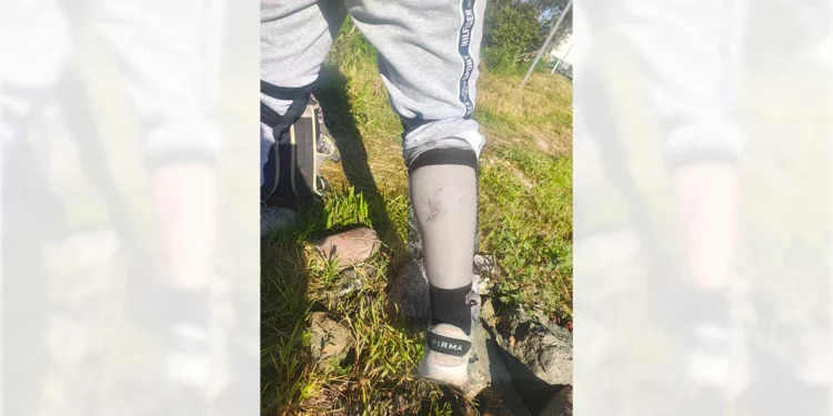 Alertan a corredores y patinadores por jauría en la carretera de San Mateo.
