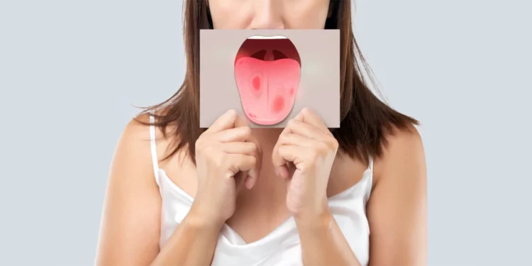 Foto: ilustrativa // La Secretaría de Salud federal recordó que la sífilis es curable si se recibe el tratamiento adecuado.