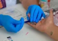 Más de 900 pruebas gratuitas de VIH fortalecen la prevención en Xoxocotlán