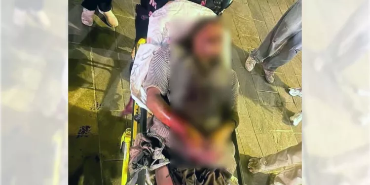 Tino, persona en situación de calle conocida por vecinos y comerciantes de Oaxaca, resultó lesionado durante una agresión que aún no ha sido esclarecida.
