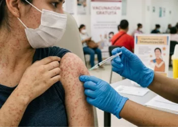No puede ser, ¿ahora el sarampión?: La OPS lanza alerta epidemiológica en las Américas