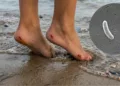 Alerta por bacteria “come carne” en EE. UU.: suman 7 muertos por Vibrio vulnificus en la costa del Golfo