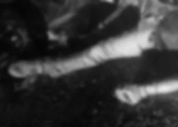 El hoy occiso fue identificado legalmente en la escena del crimen como Juan David G. M.