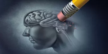 En Oaxaca, los casos acumulados de Alzheimer hasta la semana epidemiológica 34 de 2025, eran de 47