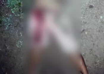 El cadáver del occiso fue levantado en calidad de desconocido y trasladado al anfiteatro de la funeraria El Porvenir.