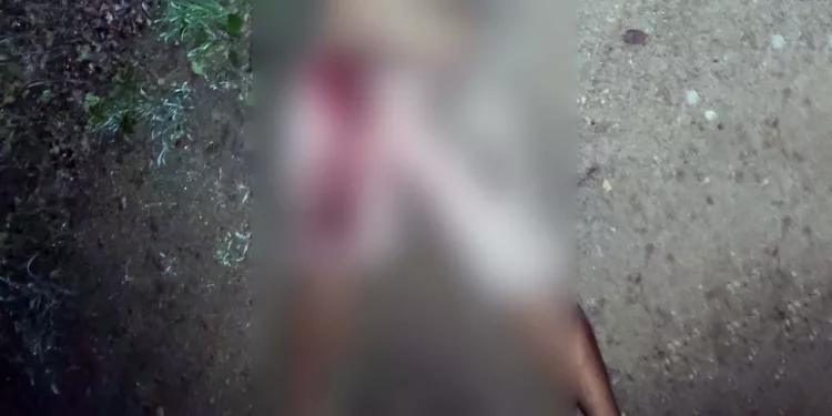 El cadáver del occiso fue levantado en calidad de desconocido y trasladado al anfiteatro de la funeraria El Porvenir.