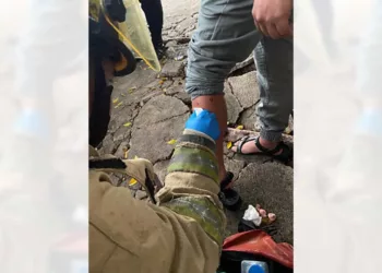 Paramédicos del cuerpo de Bomberos brindan primeros auxilios a la mujer lesionada por la jauría.