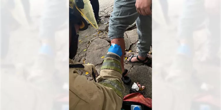 Paramédicos del cuerpo de Bomberos brindan primeros auxilios a la mujer lesionada por la jauría.