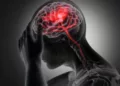 El ataque cerebral se desarrolla como resultado de una acumulación progresiva de factores de riesgo.