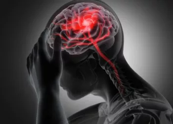 El ataque cerebral se desarrolla como resultado de una acumulación progresiva de factores de riesgo.